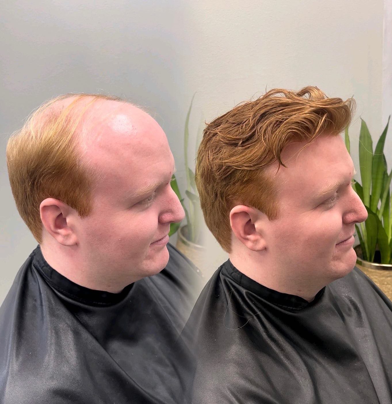 Custom men's hair system before-and-after result Red-haired client before-and-after custom men's hair system result