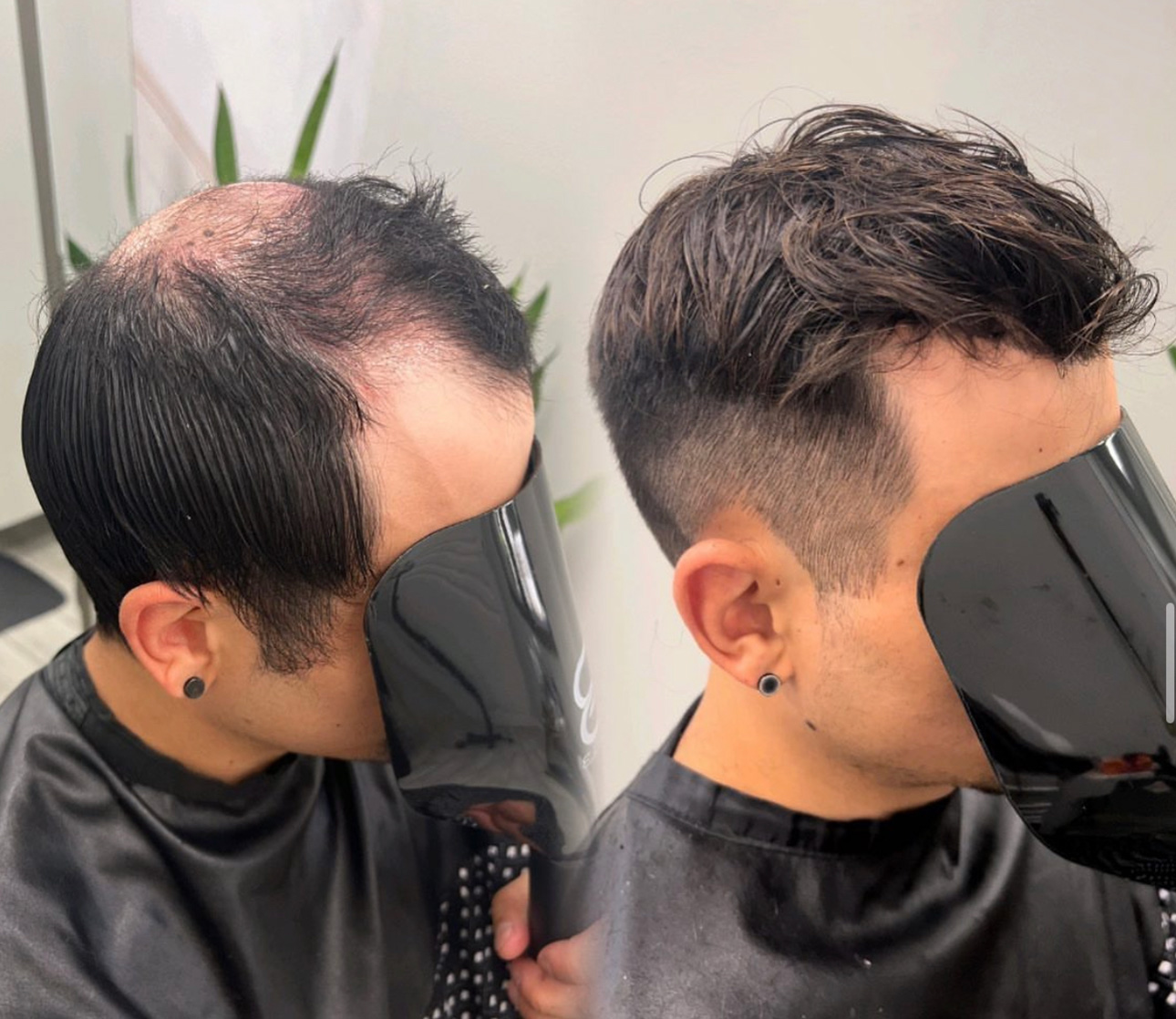 Men's hair system before-and-after result Before-and-after men's hair system result for a Winchester, California consultation