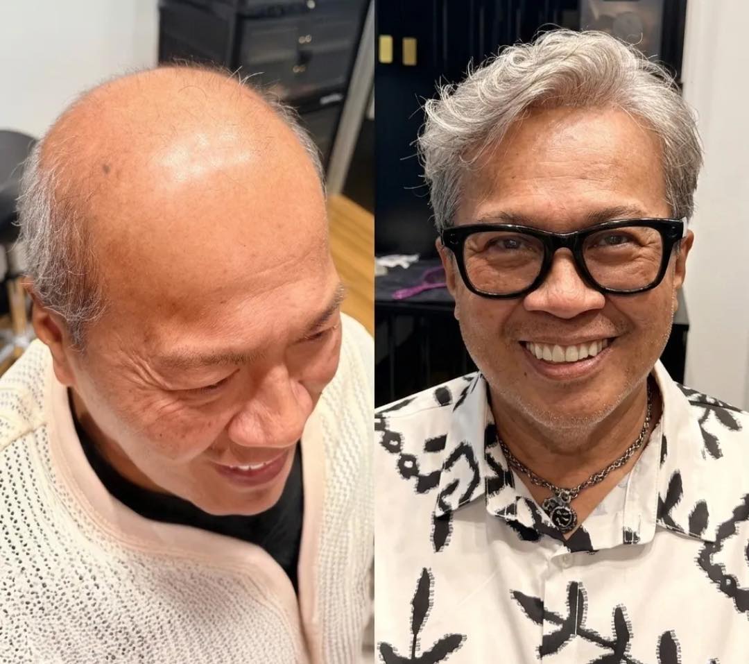 Gray men's hair system result Older client hair system before-and-after with a gray styled look