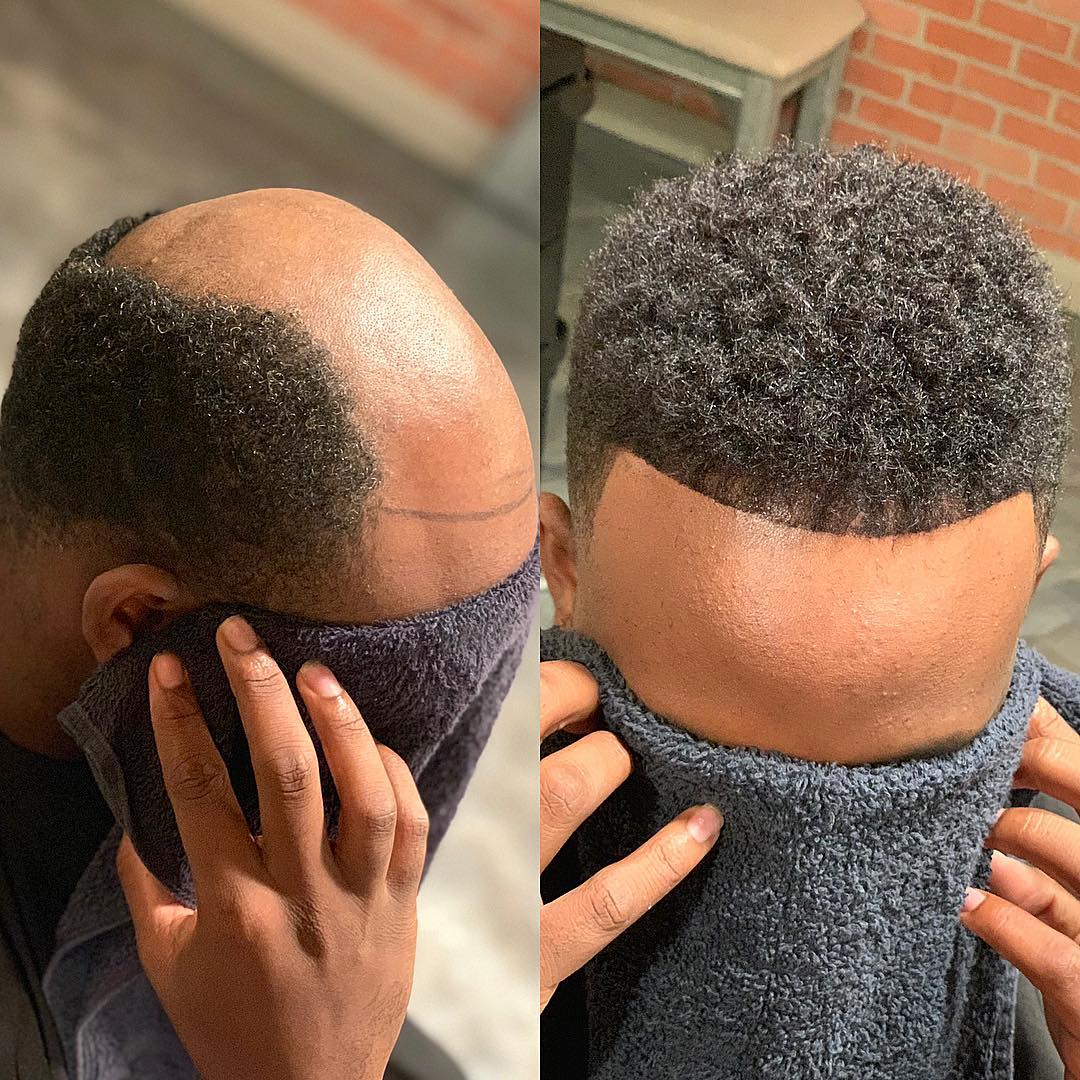 Short men's hair unit result Short men's hair unit before-and-after result